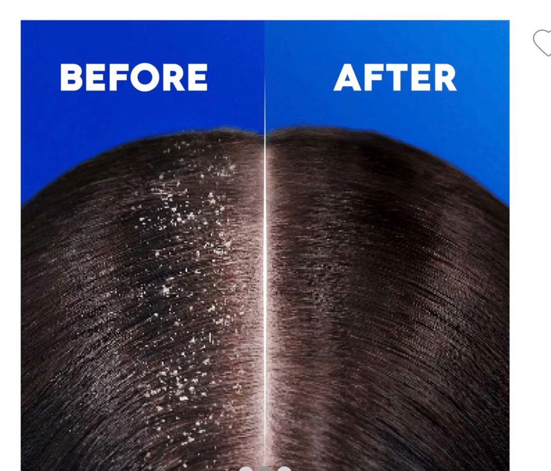 Head & Shoulders Apple Fresh Anti-Dandruff Shampoo, Up To 100% Dandruff Protection, 400ml