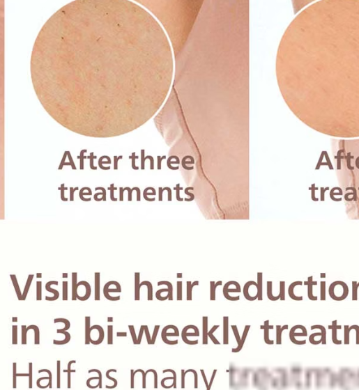 Philips Lumea 8000 Series, IPL Hair Removal Device with Pen Trimmer, 4 Attachments for Body, Face, Bikini & Underarms, BRI949/00